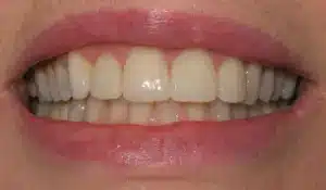 Nowak1