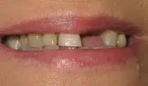 Pat_2