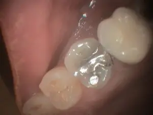 Terril1