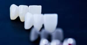 types of crowns for teeth